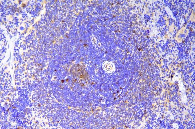 SCN11A Antibody in Immunohistochemistry (Paraffin) (IHC (P))