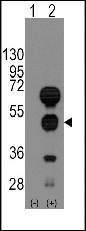 GATA4 Antibody in Western Blot (WB)