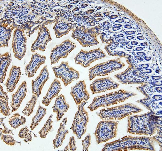 LOR Antibody in Immunohistochemistry (Paraffin) (IHC (P))