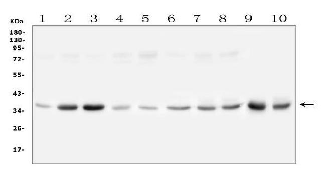 GPD1L Antibody in Western Blot (WB)