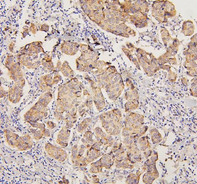 PYROXD1 Antibody in Immunohistochemistry (Paraffin) (IHC (P))