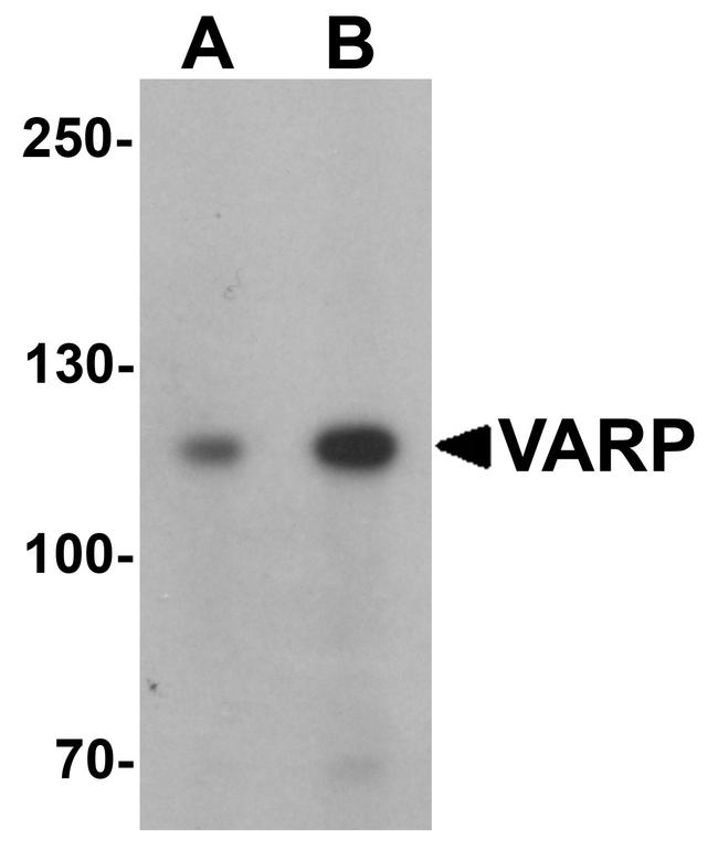 ANKRD27 Antibody in Western Blot (WB)