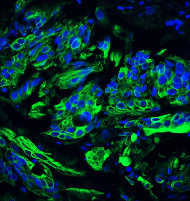 TET2 Antibody in Immunohistochemistry (Paraffin) (IHC (P))