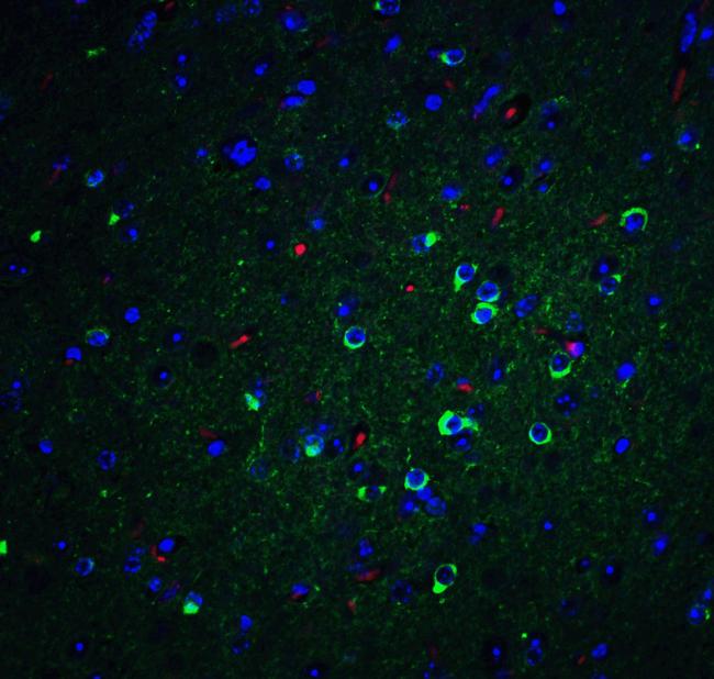 APOE Antibody in Immunohistochemistry (Paraffin) (IHC (P))