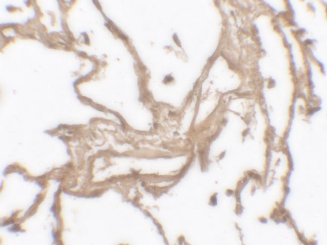 MMP9 Antibody in Immunohistochemistry (Paraffin) (IHC (P))