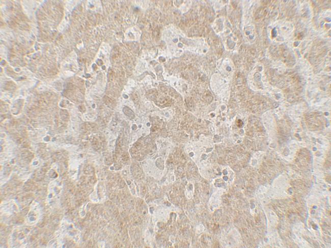 CCR7 Antibody in Immunohistochemistry (Paraffin) (IHC (P))