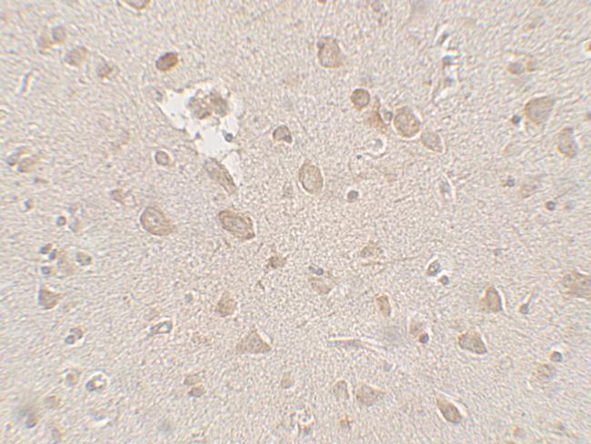 FMRP Antibody in Immunohistochemistry (Paraffin) (IHC (P))