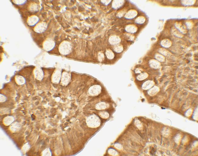 TRIM21 Antibody in Immunohistochemistry (Paraffin) (IHC (P))