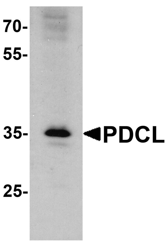 PHLP Antibody in Western Blot (WB)