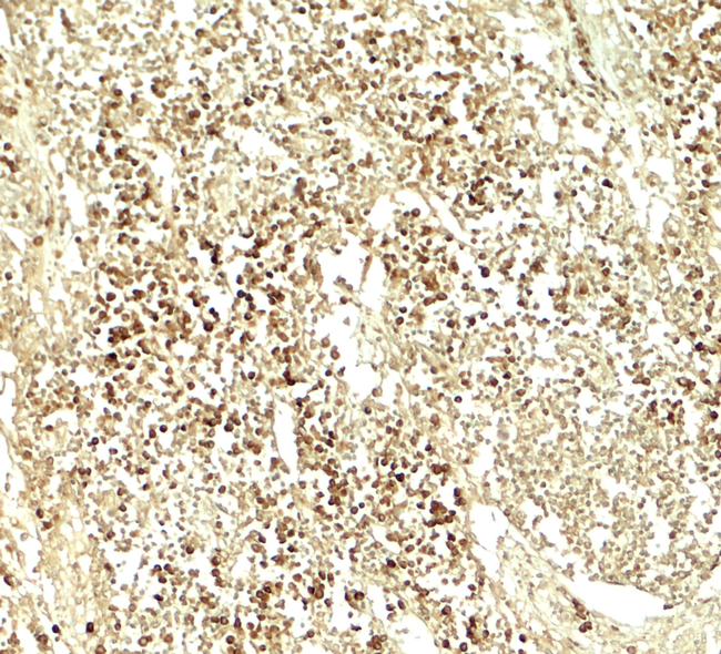 E2F3 Antibody in Immunohistochemistry (Paraffin) (IHC (P))