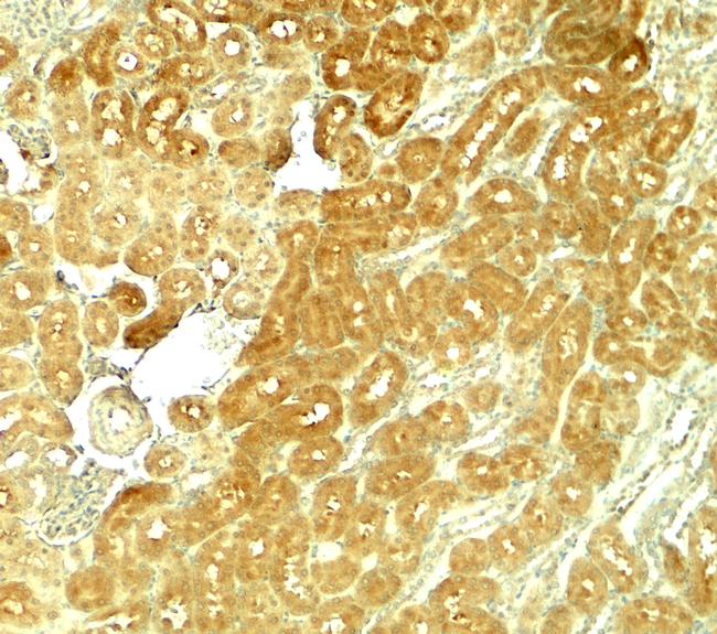 SMURF1 Antibody in Immunohistochemistry (Paraffin) (IHC (P))