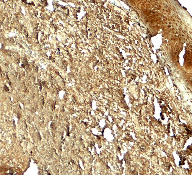 PIK3R4 Antibody in Immunohistochemistry (Paraffin) (IHC (P))