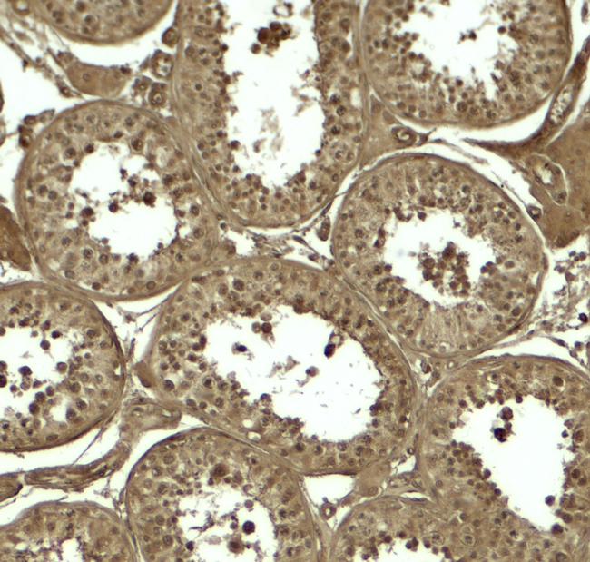 ATG4D Antibody in Immunohistochemistry (Paraffin) (IHC (P))