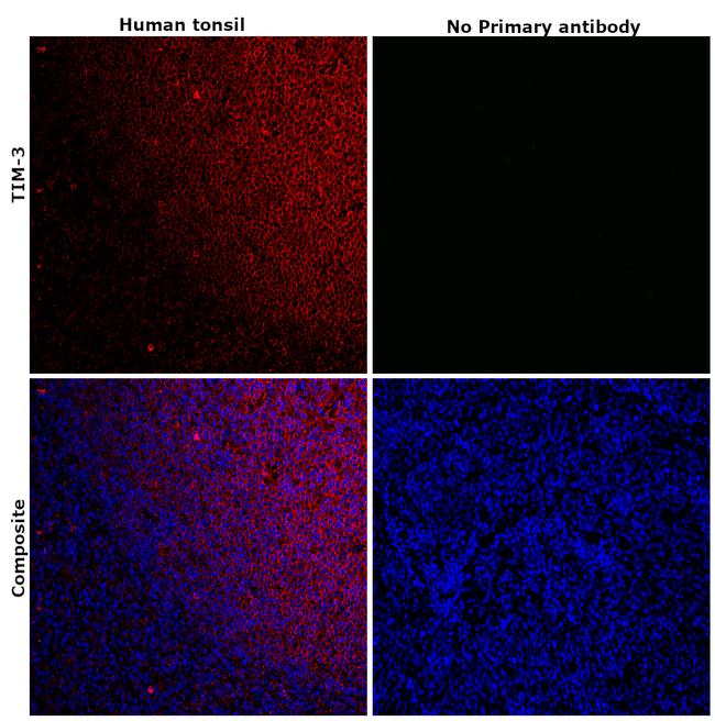 TIM-3 Antibody in Immunohistochemistry (Paraffin) (IHC (P))