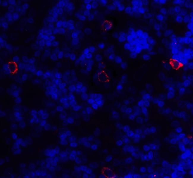 CD86 Antibody in Immunohistochemistry (Paraffin) (IHC (P))