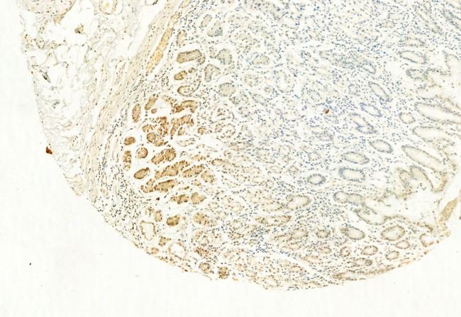 H3K4me3 Antibody in Immunohistochemistry (Paraffin) (IHC (P))