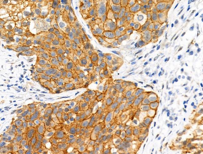 Phospho-Catenin alpha-1 (Ser655, Thr658) Antibody in Immunohistochemistry (Paraffin) (IHC (P))