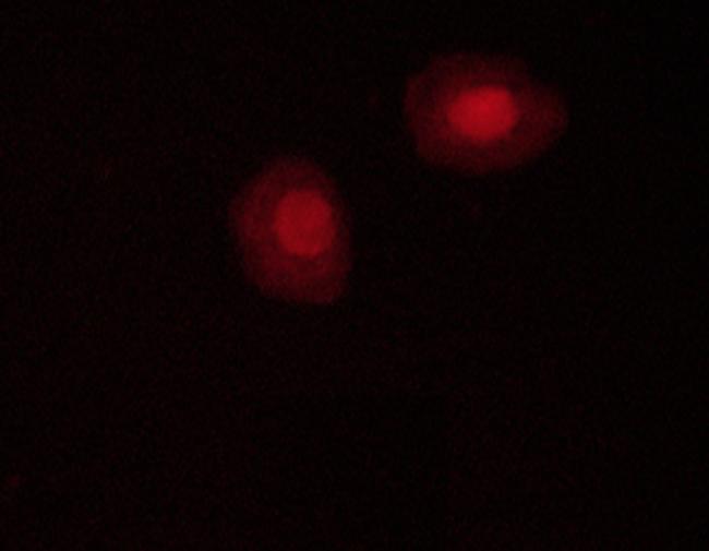 Phospho-AMPK alpha-1,2 (Thr172) Antibody in Immunocytochemistry (ICC/IF)