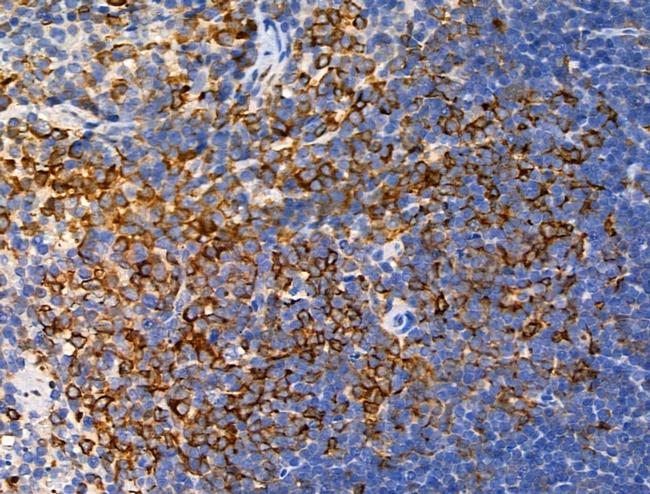 Phospho-AS160 (Ser588) Antibody in Immunohistochemistry (Paraffin) (IHC (P))