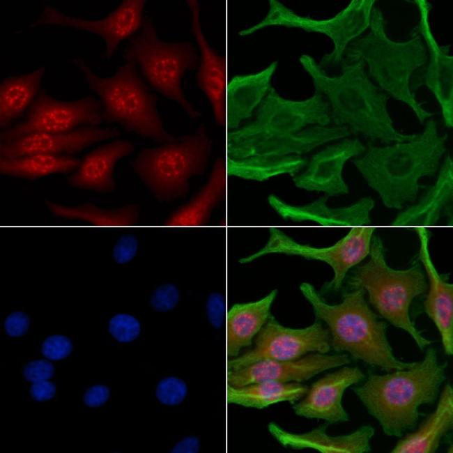 Phospho-Chk2 (Ser33, Ser35) Antibody in Immunocytochemistry (ICC/IF)