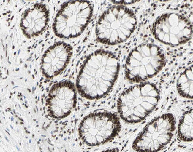 Phospho-C-Jun (Ser73) Antibody in Immunohistochemistry (Paraffin) (IHC (P))