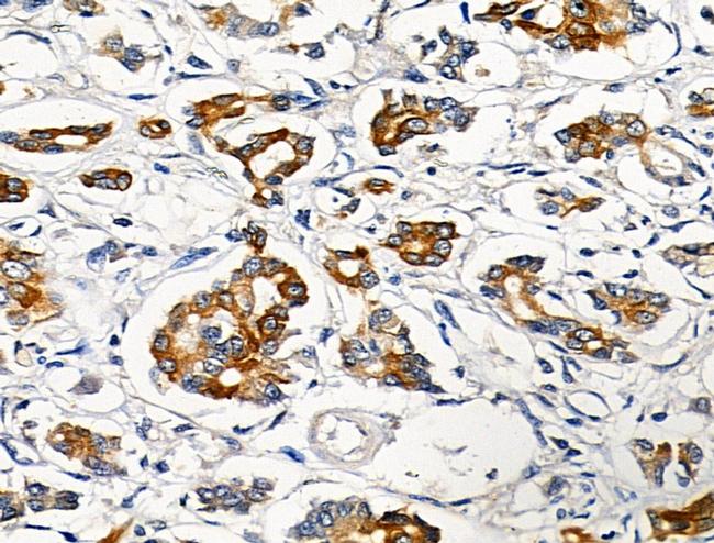 Phospho-Cytokeratin 18 (Ser51) Antibody in Immunohistochemistry (Paraffin) (IHC (P))