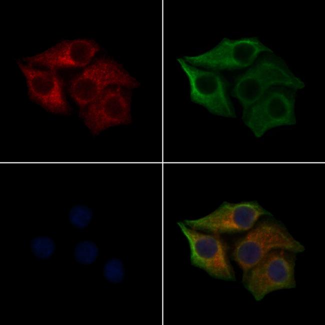 Phospho-Cytokeratin 8 (Ser432) Antibody in Immunocytochemistry (ICC/IF)