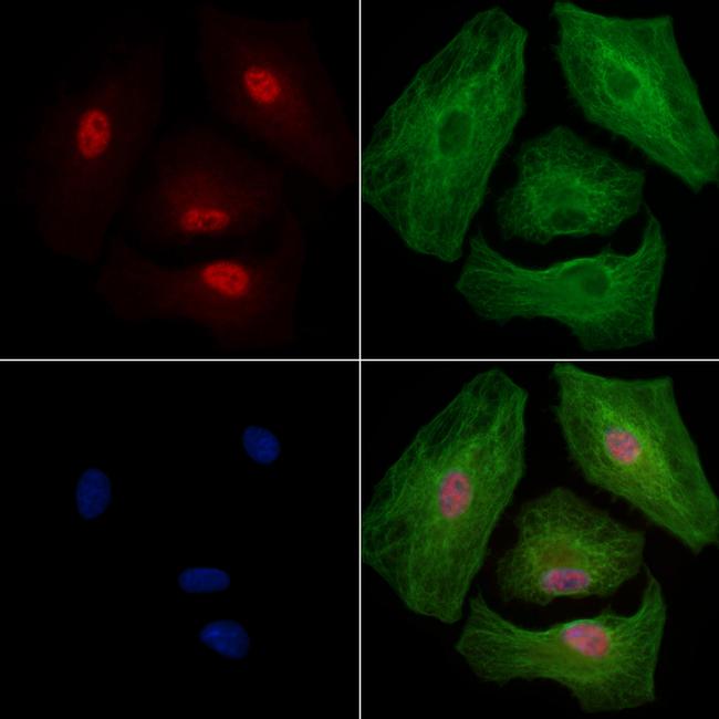 Phospho-EZH2 (Thr345) Antibody in Immunocytochemistry (ICC/IF)