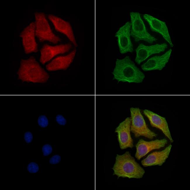 Phospho-GAP43 (Ser41) Antibody in Immunocytochemistry (ICC/IF)