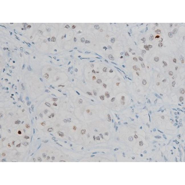 Phospho-Histone H2A.X (Ser140) Antibody in Immunohistochemistry (Paraffin) (IHC (P))