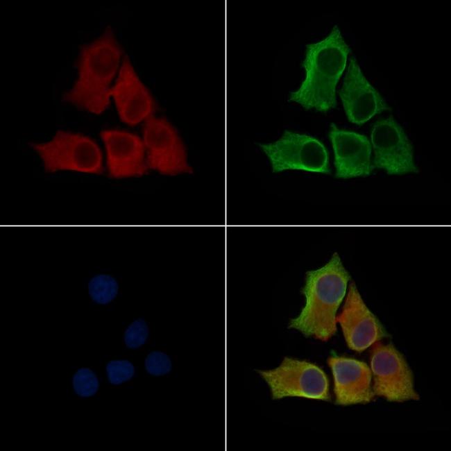 Phospho-ILK (Thr173) Antibody in Immunocytochemistry (ICC/IF)