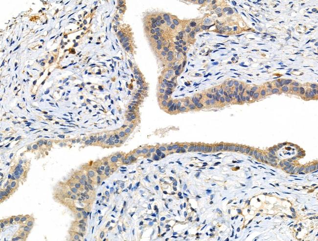 Phospho-MEK7 (Thr275) Antibody in Immunohistochemistry (Paraffin) (IHC (P))