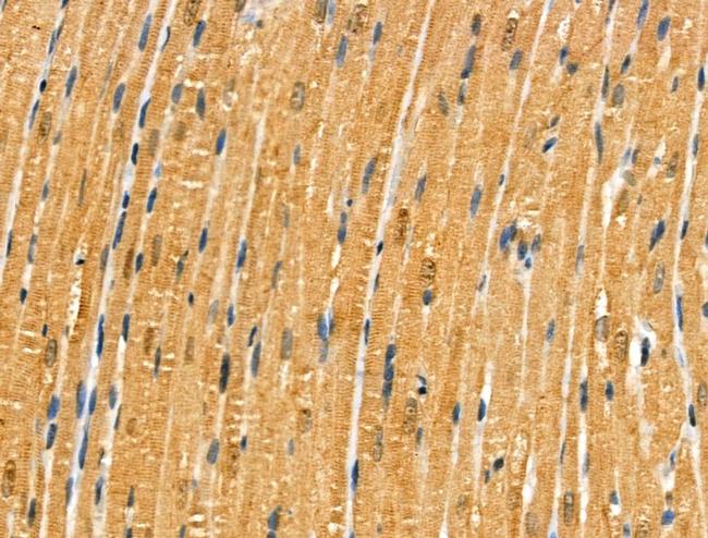 Phospho-MYPT1 (Ser473) Antibody in Immunohistochemistry (Paraffin) (IHC (P))