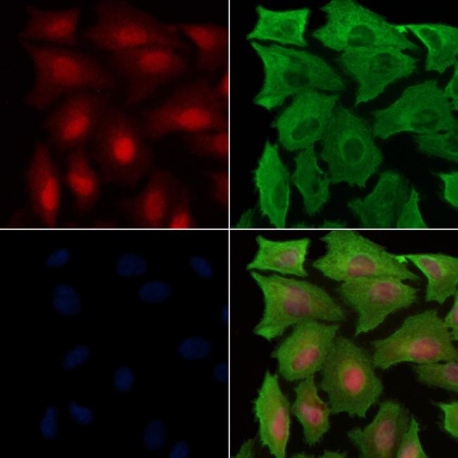 Phospho-Parkin (Ser65) Antibody in Immunocytochemistry (ICC/IF)