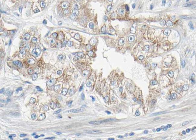 Phospho-PDGFRB (Tyr1021) Antibody in Immunohistochemistry (Paraffin) (IHC (P))