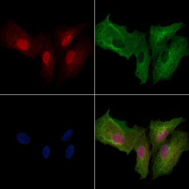 Phospho-PFKFB3 (Ser461) Antibody in Immunocytochemistry (ICC/IF)