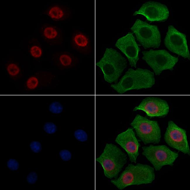 Phospho-RB1 (Ser780) Antibody in Immunocytochemistry (ICC/IF)