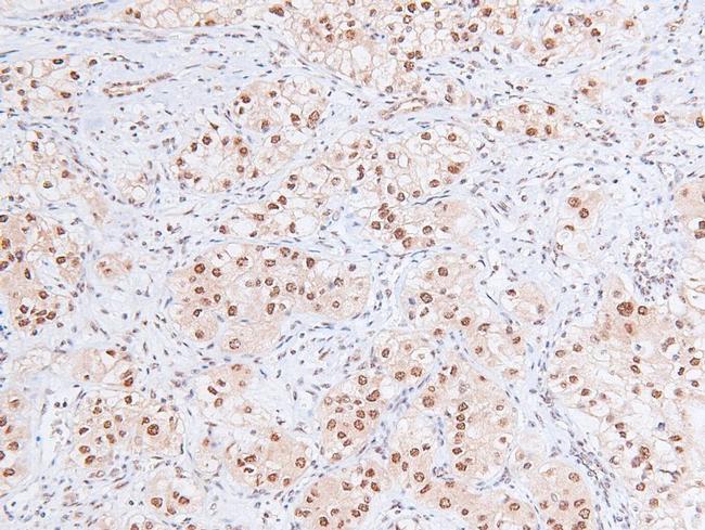 Phospho-RB1 (Ser788) Antibody in Immunohistochemistry (Paraffin) (IHC (P))