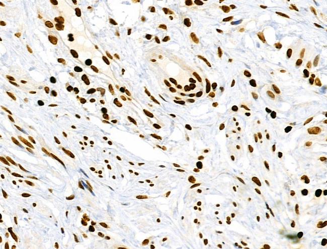 Phospho-RSK Pan (Ser221, Ser227, Ser218, Ser232) Antibody in Immunohistochemistry (Paraffin) (IHC (P))