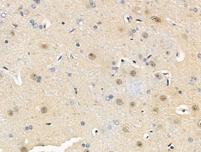 Phospho-MAPKAP1 (Thr86) Antibody in Immunohistochemistry (Paraffin) (IHC (P))