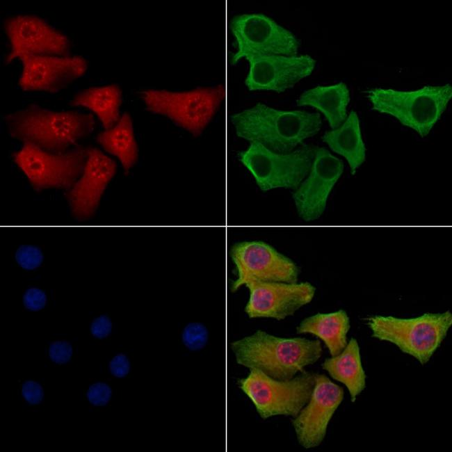 Phospho-SNAIL (Ser11) Antibody in Immunocytochemistry (ICC/IF)