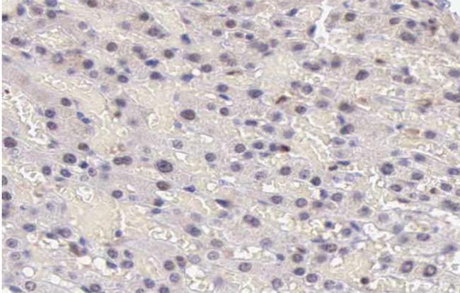 Phospho-STAT5A/B (Tyr694) Antibody in Immunohistochemistry (Paraffin) (IHC (P))