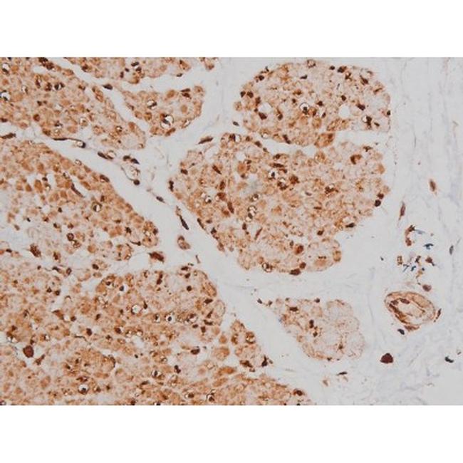 Phospho-Tau (Ser579) Antibody in Immunohistochemistry (Paraffin) (IHC (P))