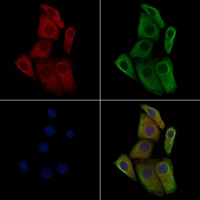 Phospho-TGFBR2 (Ser553) Antibody in Immunocytochemistry (ICC/IF)