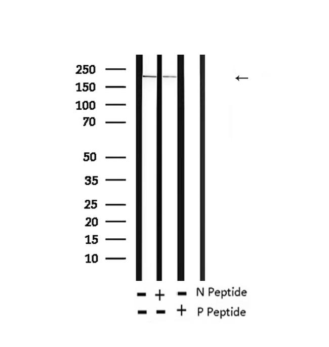 Phospho-TSC2 (Ser939) Antibody in Western Blot (WB)