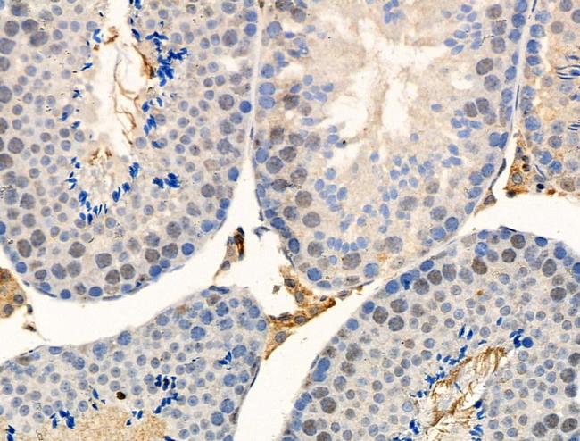 Phospho-UBA52 (Ser65) Antibody in Immunohistochemistry (Paraffin) (IHC (P))