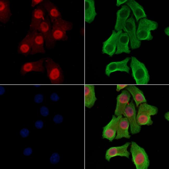 Phospho-ZEB2 (Ser784) Antibody in Immunocytochemistry (ICC/IF)