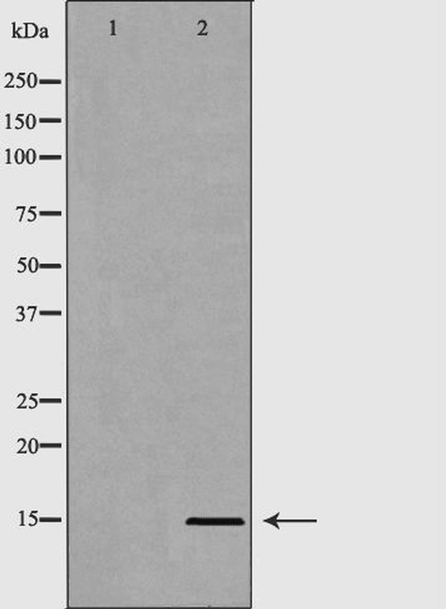 H3R8me2 Antibody in Western Blot (WB)