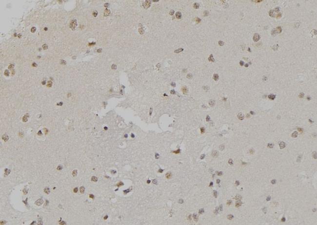 H3K4me2 Antibody in Immunohistochemistry (Paraffin) (IHC (P))