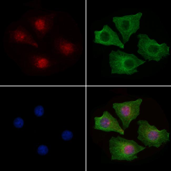 H2BK5ac Antibody in Immunocytochemistry (ICC/IF)